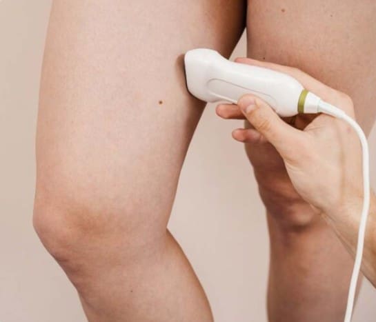 The Secret Vein Clinic